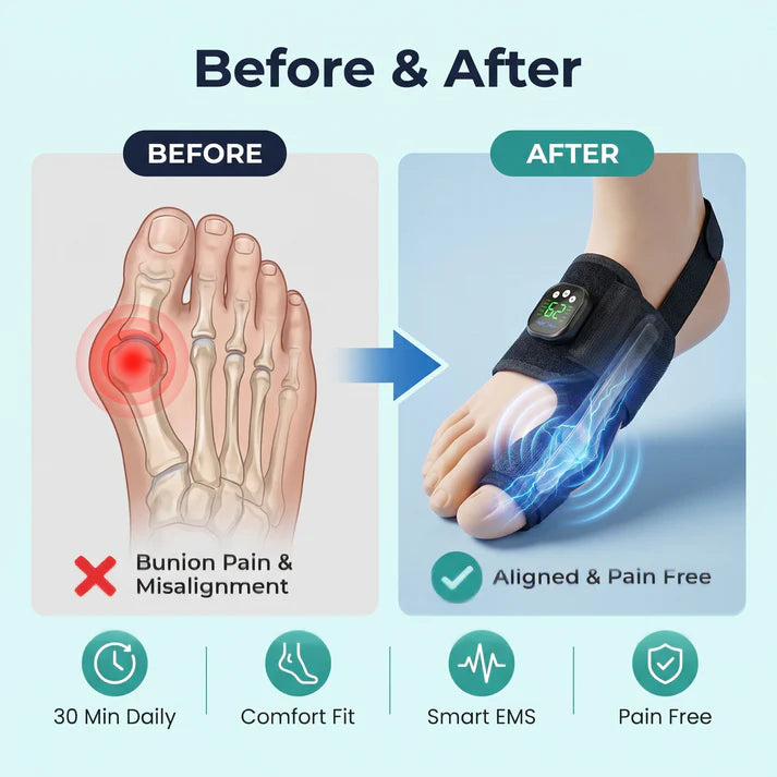 Lavirac Pro - EMS Bunion Corrector