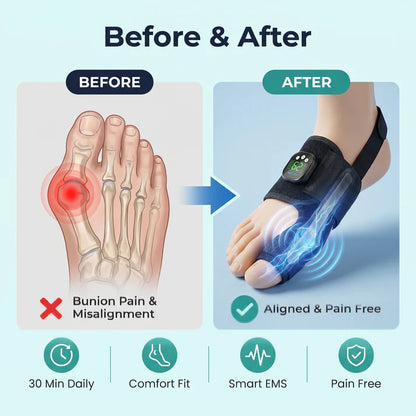 Lavirac Pro - EMS Bunion Corrector
